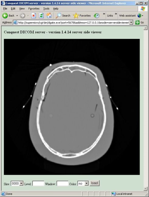 Web access to the Conquest DICOM server with Apache2, connects to several viewers such as DWV and Weasis (Windows/Linux)